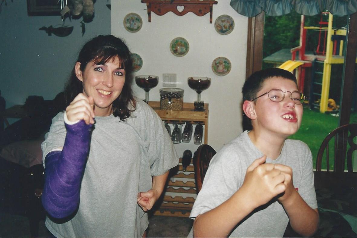 Broken arm with Justin